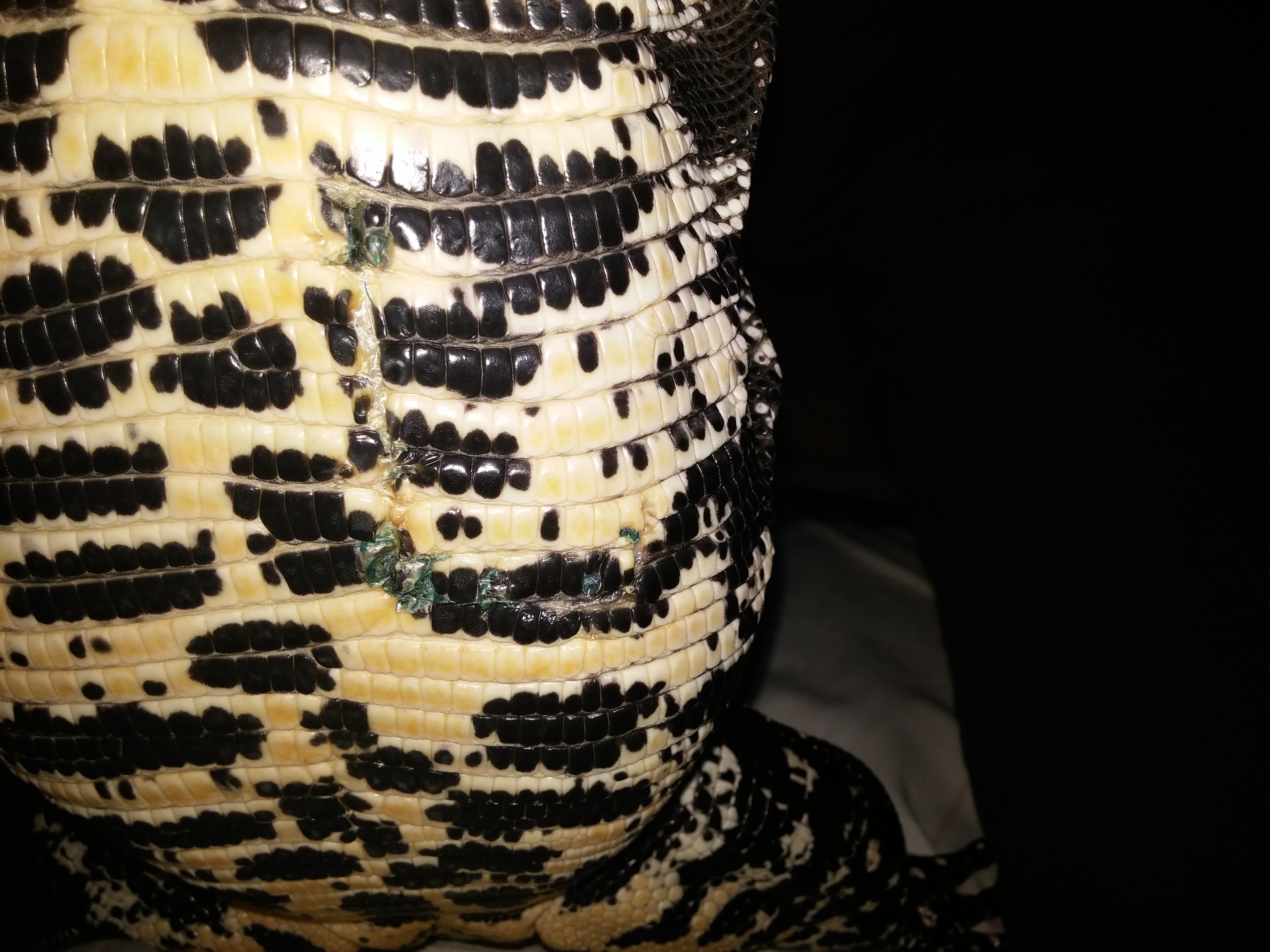 2 months after surgery